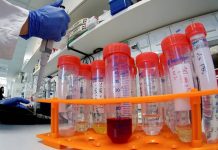 Αρνητικά τα 424 ανιχνευτικά Rapid tests covid19 στην ΤΚ Αγίου Γεωργίου