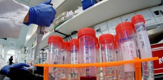 Αρνητικά τα 424 ανιχνευτικά Rapid tests covid19 στην ΤΚ Αγίου Γεωργίου