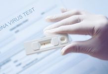 Για τους επιστρέφοντες στα σπίτια τους λόγω εορτών – Δωρεάν Rapid Test από το Δήμο Για τους επιστρέφοντες στα σπίτια τους λόγω εορτών – Δωρεάν Rapid Test από το Δήμο